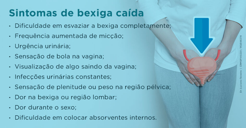 Sintomas de bexiga caída Dificuldade em esvaziar a bexiga completamente; Frequência aumentada de micção; Urgência urinária; Sensação de bola na vagina; Visualização de algo saindo da vagina; Infecções urinárias constantes; Sensação de plenitude ou peso na região pélvica; Dor na bexiga ou região lombar; Dor durante o sexo; Dificuldade em colocar absorventes internos.