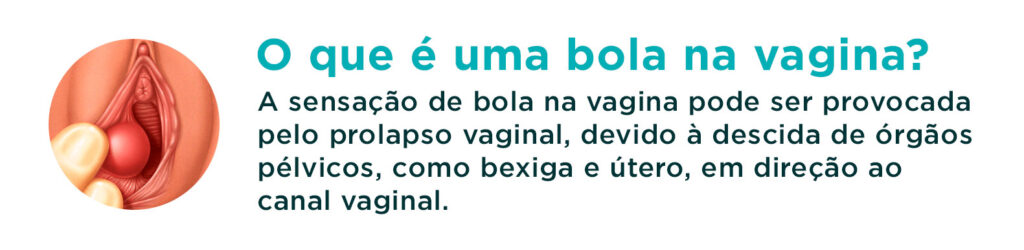 A sensação de bola na vagina pode ser provocada pelo prolapso vaginal, devido à descida de órgãos pélvicos, como bexiga e útero, em direção ao canal vaginal.